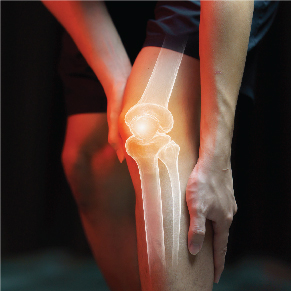 How Can Knee Replacement Change your Life? 